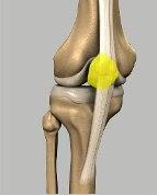 Patella