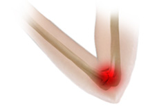 Ulnar Collateral Ligament Reconstruction (“Tommy John”)